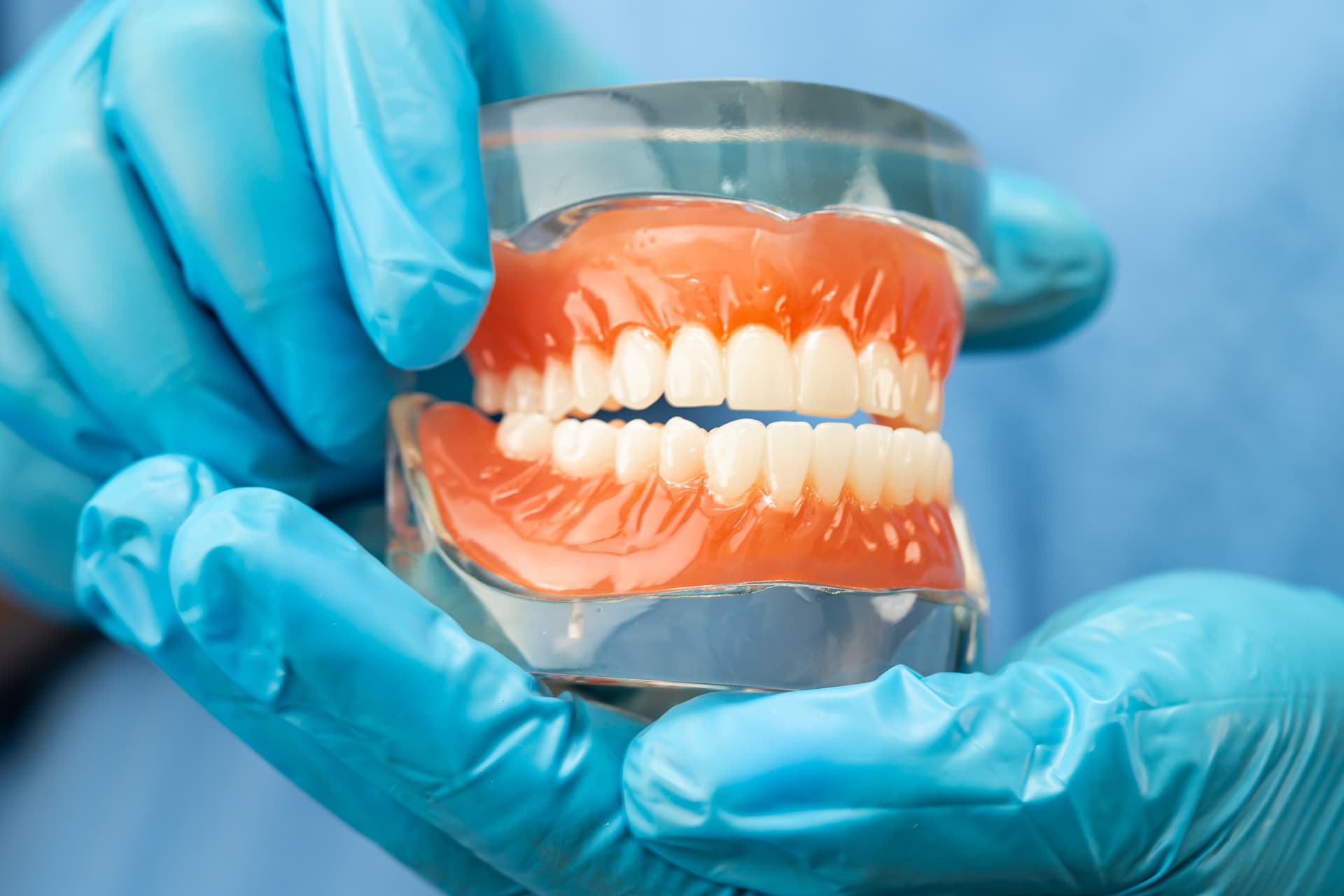 Partial Denture