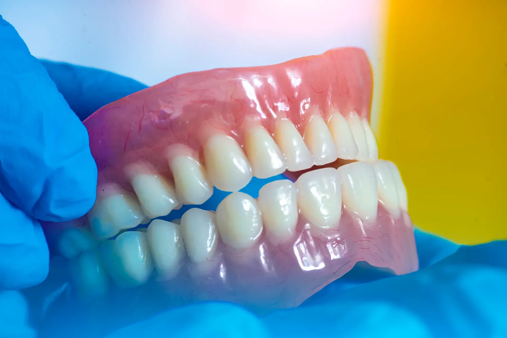 Partial Denture
