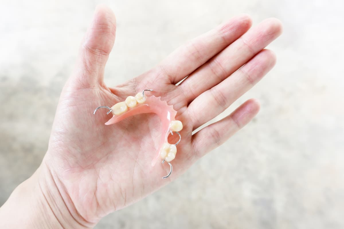 Partial Denture