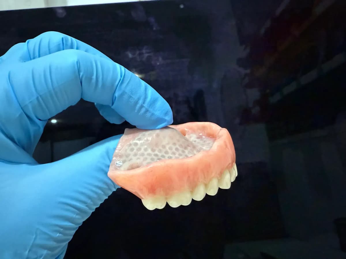 Full Denture with Chrome Mesh