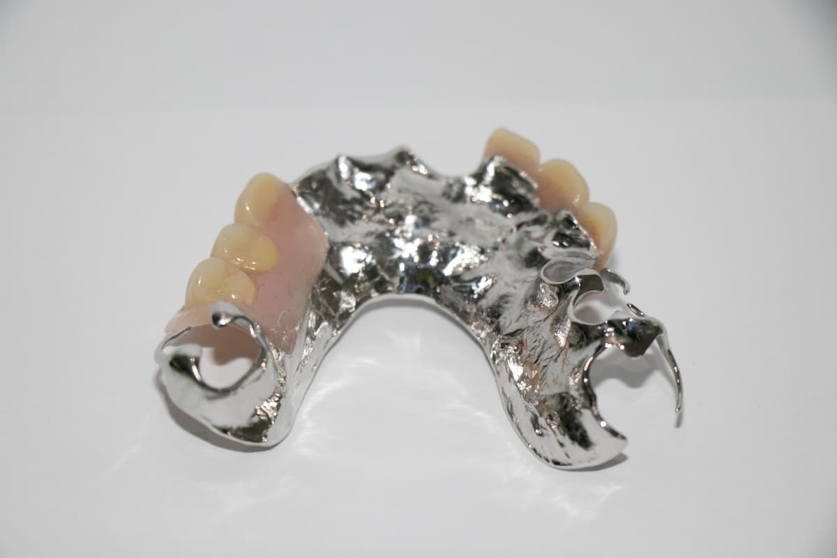 Chrome Partial Denture